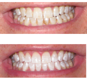 Teeth